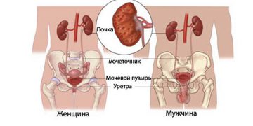 Пиелонефрит симптомы и лечение